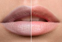 2 WAYS TO GET RID OF DARK LIPS