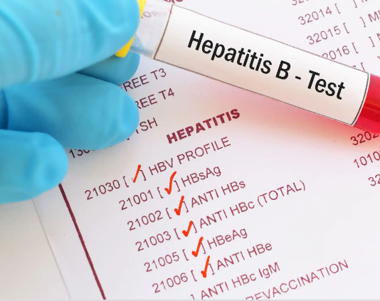 Hepatitis B: Abubuwa 5 Don Gujewa kamuwa da Cutar