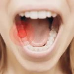Home remedy for toothache.