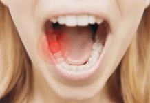 Home remedy for toothache.