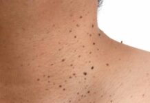 YADDA AKE MAGANCE MATSALAR FATA